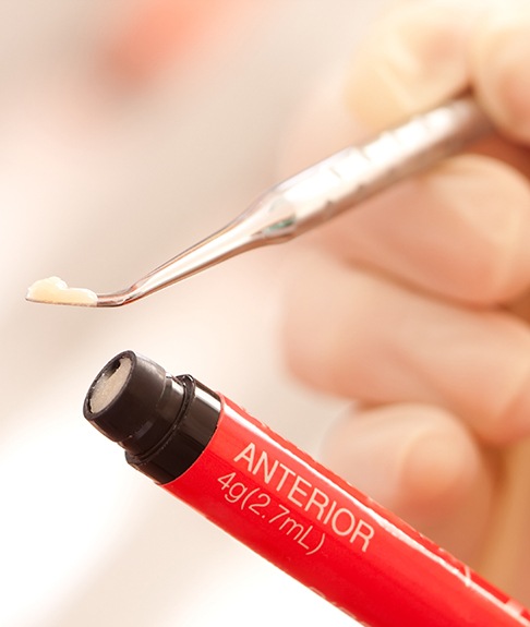 A dentist holding composite resin used for cosmetic dental bonding