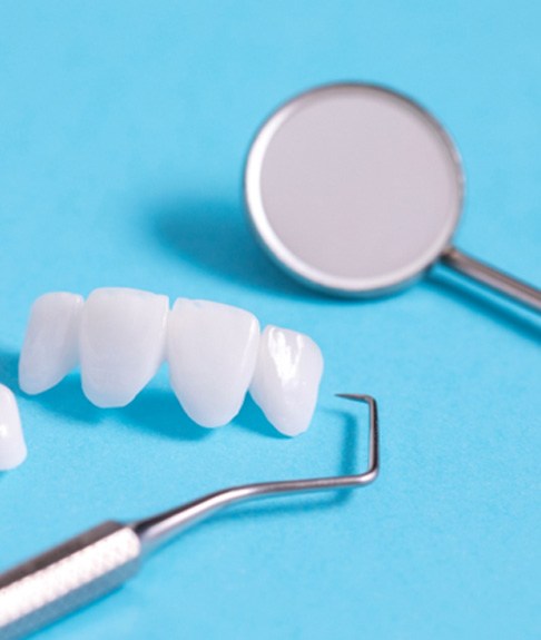 an example of a dental bridge in Lakewood