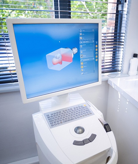 iTero scan displayed on computer monitor in dental office