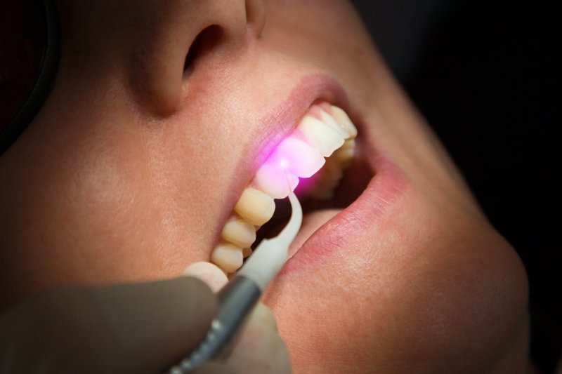 A woman having her dentistry done via soft tissue laser