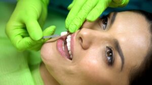Patient having veneer placed.
